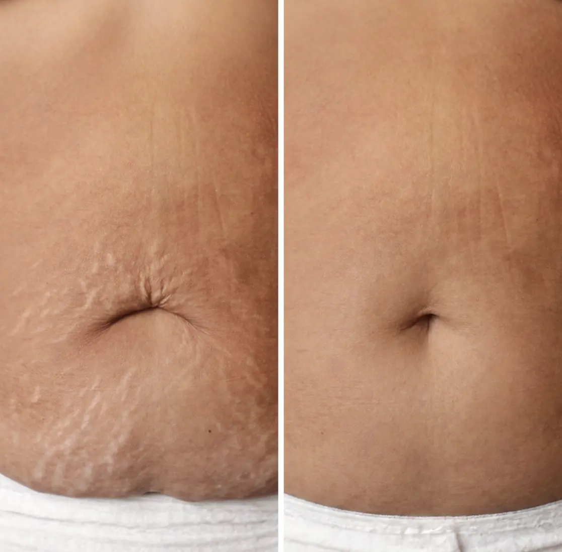 product-example1-ppv3